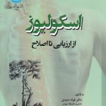 اسکولیوز؛ از ارزیابی تا اصلاح