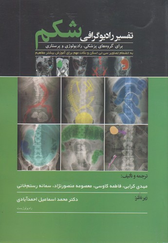 تفسیر رادیوگرافی شکم برای گروههای پزشکی، رادیولوژی و پرستاری تفسیر رادیوگرافی شکم برای گروههای پزشکی، رادیولوژی و پرستاری