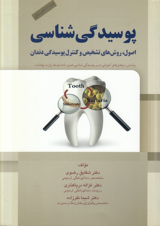 پوسیدگی‌شناسی؛ اصول، روش‌های تشخیص و کنترل پوسیدگی دندان